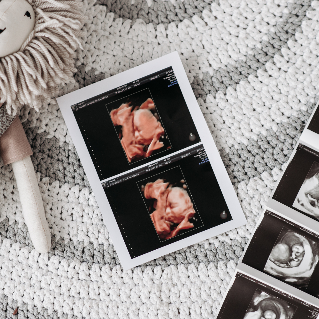 Expectant parents view 3D ultrasound on smartphone; plush toy in calming nursery setting.